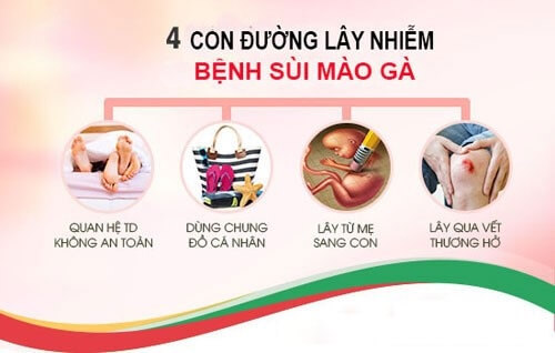 Bệnh sùi mào gà lây nhiễm qua đường nào?